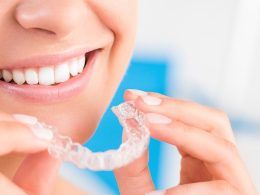 What is Invisalign? & How Much Are Invisalign in Canada?